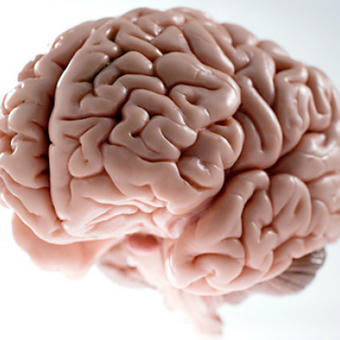 Scumbag Brain